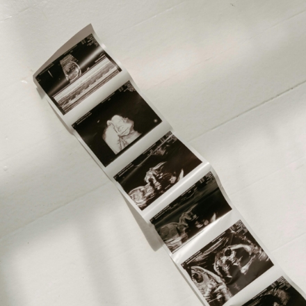 Infekcje intymne – diagnostyka i kompleksowe leczenie